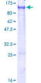 PCIF1 Protein - 12.5% SDS-PAGE of human C20orf67 stained with Coomassie Blue