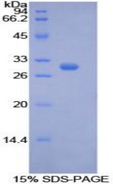 PCK1 Protein - Recombinant Phosphoenolpyruvate Carboxykinase 1, Soluble By SDS-PAGE