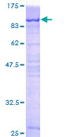 PCM1 Protein - 12.5% SDS-PAGE of human PCM1 stained with Coomassie Blue