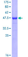 PCMT1 Protein - 12.5% SDS-PAGE of human PCMT1 stained with Coomassie Blue