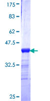 PCMT1 Protein - 12.5% SDS-PAGE Stained with Coomassie Blue.