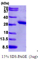 PCMT1 Protein