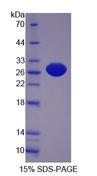 PCMT1 Protein - Recombinant  Protein L-Isoaspartate-O-Methyltransferase By SDS-PAGE