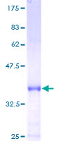 PCNA-Associated Factor Protein - 12.5% SDS-PAGE of human KIAA0101 stained with Coomassie Blue