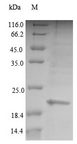 PCNA Protein - (Tris-Glycine gel) Discontinuous SDS-PAGE (reduced) with 5% enrichment gel and 15% separation gel.