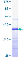PCNA Protein - 12.5% SDS-PAGE Stained with Coomassie Blue