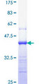PCNA Protein - 12.5% SDS-PAGE Stained with Coomassie Blue