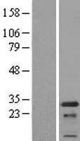 PCNP Protein - Western validation with an anti-DDK antibody * L: Control HEK293 lysate R: Over-expression lysate