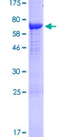 PCOLCE Protein - 12.5% SDS-PAGE of human PCOLCE stained with Coomassie Blue