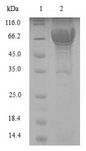 PCOLCE2 Protein - (Tris-Glycine gel) Discontinuous SDS-PAGE (reduced) with 5% enrichment gel and 15% separation gel.