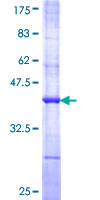 PCOLCE2 Protein - 12.5% SDS-PAGE Stained with Coomassie Blue.
