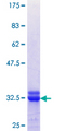 PCP4 / PEP19 Protein - 12.5% SDS-PAGE Stained with Coomassie Blue