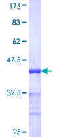 PCSK1 Protein - 12.5% SDS-PAGE Stained with Coomassie Blue.