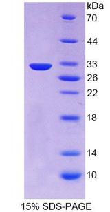 PCSK1 Protein - Recombinant  Proprotein Convertase Subtilisin/Kexin Type 1 By SDS-PAGE