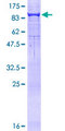 PCSK2 Protein - 12.5% SDS-PAGE of human PCSK2 stained with Coomassie Blue