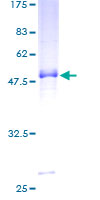 PCSK4 Protein - 12.5% SDS-PAGE of human PCSK4 stained with Coomassie Blue