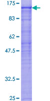 PCSK7 / PC7 Protein - 12.5% SDS-PAGE of human PCSK7 stained with Coomassie Blue