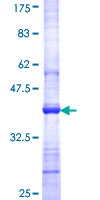 PCSK7 / PC7 Protein - 12.5% SDS-PAGE Stained with Coomassie Blue.