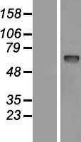 PCSK9 Protein - Western validation with an anti-DDK antibody * L: Control HEK293 lysate R: Over-expression lysate
