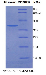PCSK9 Protein - Recombinant Proprotein Convertase Subtilisin/Kexin Type 9 By SDS-PAGE