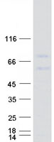 PCSK9 Protein - Purified recombinant protein PCSK9 was analyzed by SDS-PAGE gel and Coomassie Blue Staining