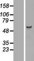 PCTK3 / CDK18 Protein - Western validation with an anti-DDK antibody * L: Control HEK293 lysate R: Over-expression lysate