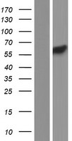 PCTK3 / CDK18 Protein - Western validation with an anti-DDK antibody * L: Control HEK293 lysate R: Over-expression lysate
