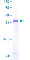 PCTP Protein - 12.5% SDS-PAGE of human PCTP stained with Coomassie Blue