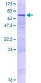 PCYOX1L Protein - 12.5% SDS-PAGE of human PCYOX1L stained with Coomassie Blue