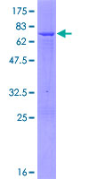 PCYT1A / CCT Alpha Protein - 12.5% SDS-PAGE of human PCYT1A stained with Coomassie Blue