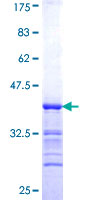 PCYT1A / CCT Alpha Protein - 12.5% SDS-PAGE Stained with Coomassie Blue.