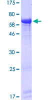 PCYT2 / ET Protein - 12.5% SDS-PAGE of human PCYT2 stained with Coomassie Blue