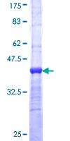PCYT2 / ET Protein - 12.5% SDS-PAGE Stained with Coomassie Blue