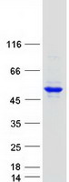 PCYT2 / ET Protein - Purified recombinant protein PCYT2 was analyzed by SDS-PAGE gel and Coomassie Blue Staining