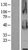 PD-L2 / PDCD1LG2 / CD273 Protein - Western validation with an anti-DDK antibody * L: Control HEK293 lysate R: Over-expression lysate