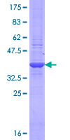 PD-L2 / PDCD1LG2 / CD273 Protein - 12.5% SDS-PAGE Stained with Coomassie Blue.