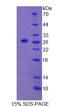 PD-L2 / PDCD1LG2 / CD273 Protein - Recombinant Programmed Cell Death Protein 1 Ligand 2 By SDS-PAGE