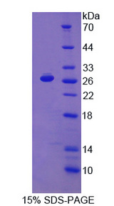 PD-L2 / PDCD1LG2 / CD273 Protein - Recombinant Programmed Cell Death Protein 1 Ligand 2 By SDS-PAGE