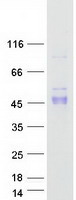 PD-L2 / PDCD1LG2 / CD273 Protein - Purified recombinant protein PDCD1LG2 was analyzed by SDS-PAGE gel and Coomassie Blue Staining