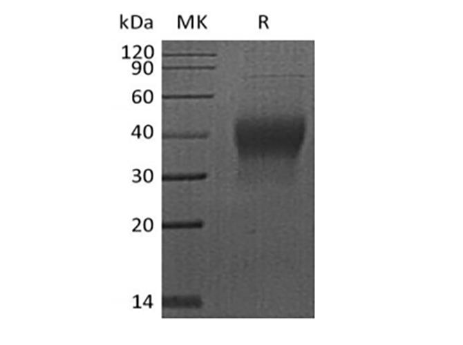 PDCD1 / CD279 / PD-1 Protein - Recombinant Human PDCD1/PD-1/CD279 (C-6His-Avi) Biotinylated