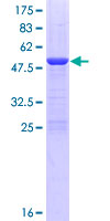 PDCD10 Protein - 12.5% SDS-PAGE of human PDCD10 stained with Coomassie Blue