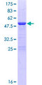 PDCD10 Protein - 12.5% SDS-PAGE of human PDCD10 stained with Coomassie Blue