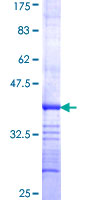 PDCD10 Protein - 12.5% SDS-PAGE Stained with Coomassie Blue.