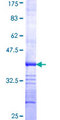 PDCD10 Protein - 12.5% SDS-PAGE Stained with Coomassie Blue.