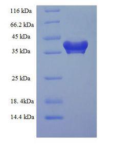 PDCD10 Protein