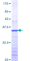 PDCD11 Protein - 12.5% SDS-PAGE Stained with Coomassie Blue.