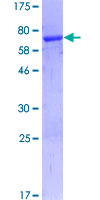 PDCD2 Protein - 12.5% SDS-PAGE of human PDCD2 stained with Coomassie Blue