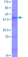 PDCD2L Protein - 12.5% SDS-PAGE of human MGC13096 stained with Coomassie Blue