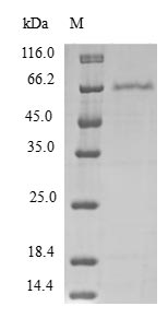 PDCD2L Protein - (Tris-Glycine gel) Discontinuous SDS-PAGE (reduced) with 5% enrichment gel and 15% separation gel.