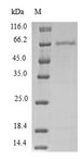 PDCD2L Protein - (Tris-Glycine gel) Discontinuous SDS-PAGE (reduced) with 5% enrichment gel and 15% separation gel.